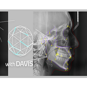 eZOrtho For Smart3D v20 for AutoCAD 2020