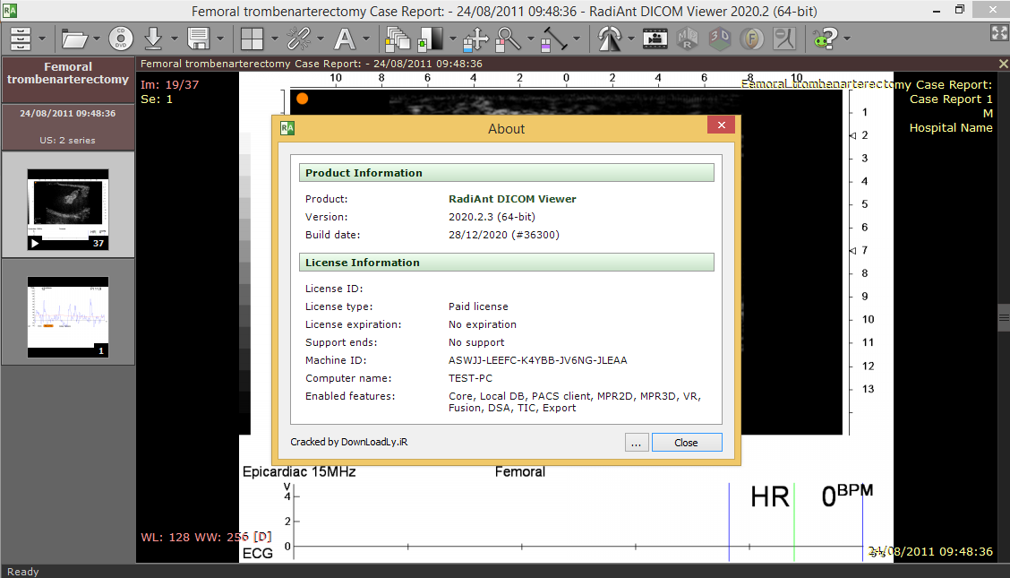 Pictures · RadiAnt DICOM Viewer 2025.1