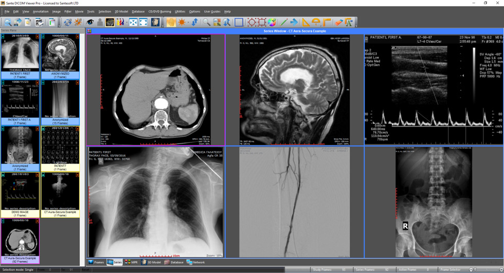 Pictures · Sante DICOM Viewer Pro 14.4.1