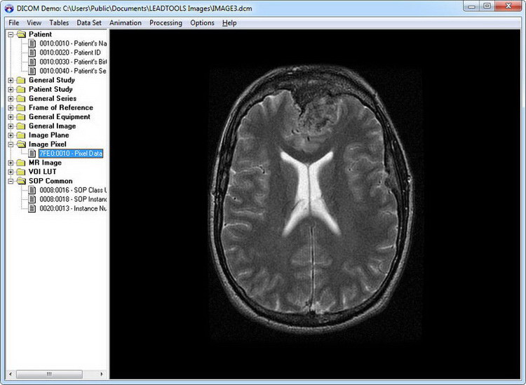 Pictures · Dicom VCL 3.8 D6-D2010 Full Source