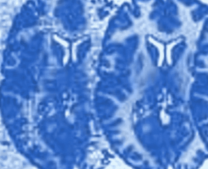 Coursera — Neuroscience and Neuroimaging Specialization 2024-12