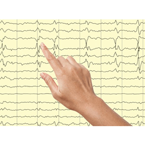 Udemy — Learn Essentials of Adult Electroencephalography (EEG) 2023-8