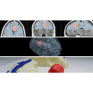 Udemy — Medical Imaging, 3D Modelling and 3D Printing – Beginners 2021-10